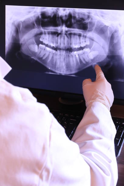 Best Broken or Cracked Tooth Emergency Dentist in North Myrtle Beach, SC