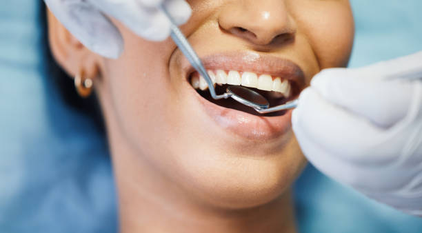 Best Emergency Root Canal Treatment in North Myrtle Beach, SC