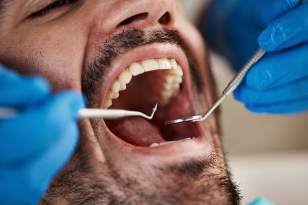 Best Emergency Cosmetic Dentistry in North Myrtle Beach, SC