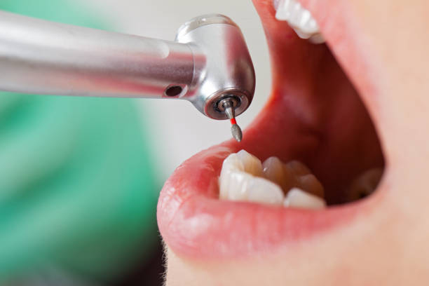 Best Mobile Emergency Dentist in North Myrtle Beach, SC